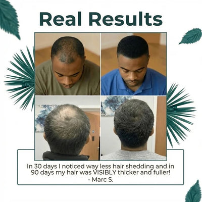 DHT Blocker - Hair & Skin Formula with Herbal Ingredients
